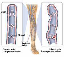 Doctor Formulation